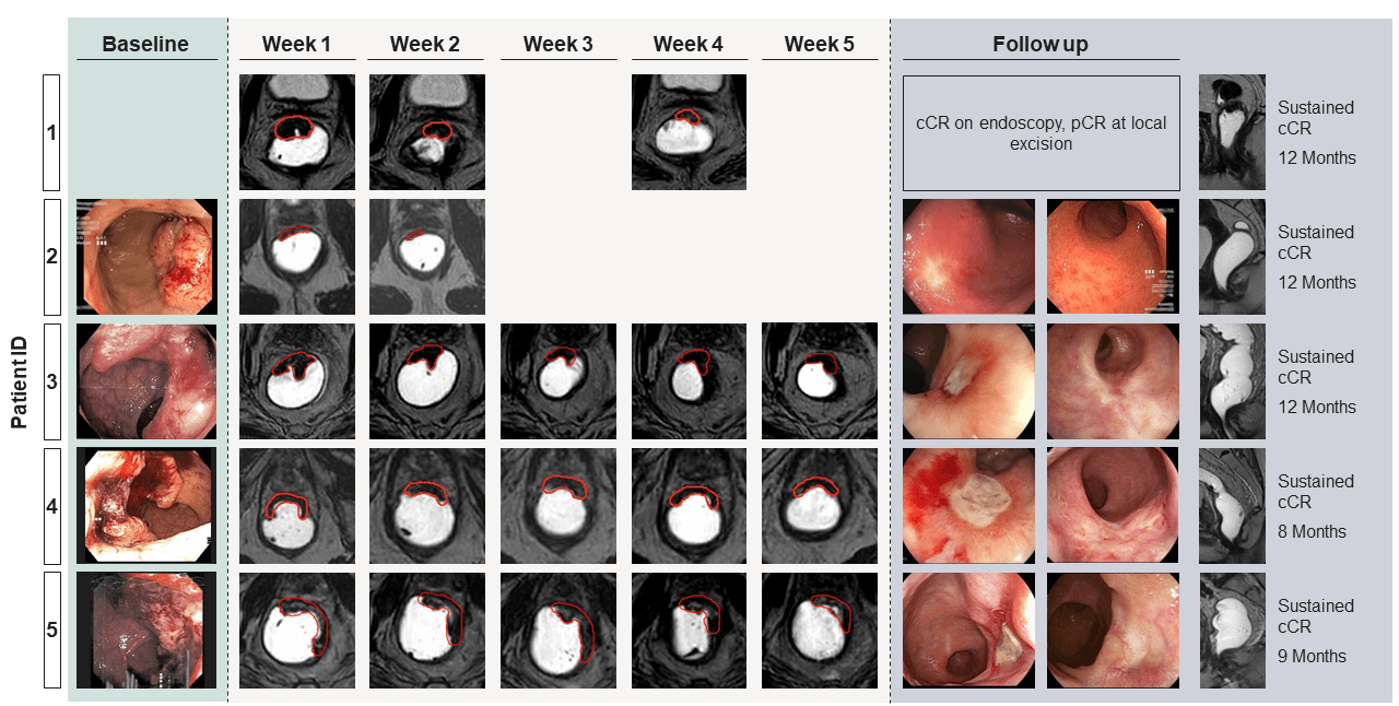  Endoscopic findings for five patients over 5 weeks